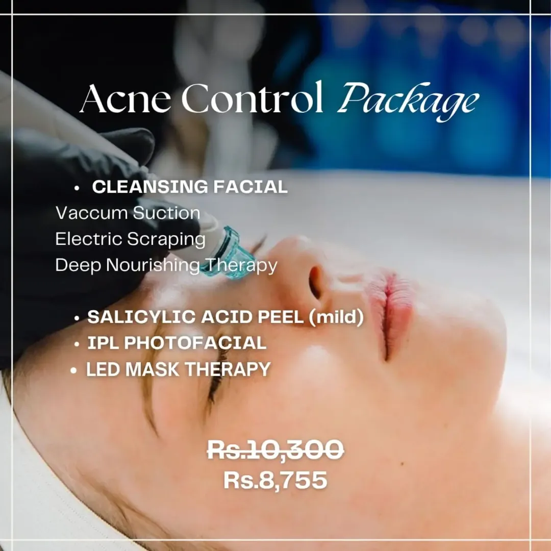 Acne Control package: cleansing facial, salicylic peel, IPL photofacial and LED mask